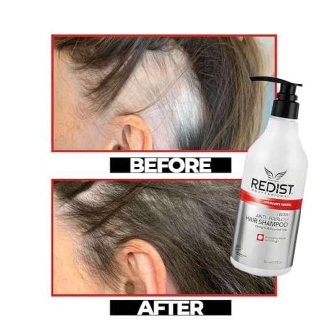 Redist Biotin Anti-Hairloss šampon proti padání vlasů 500 ml